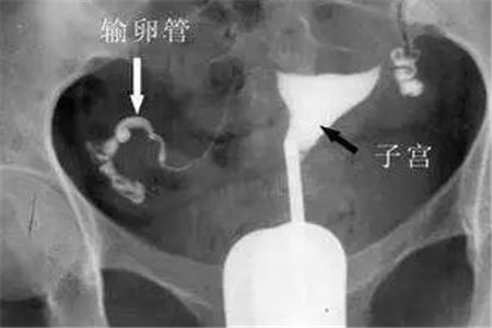 水浒英雄谱火热拍摄中陈龙身兼二职演技与招考资讯双重奏鸣