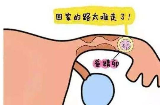 气蒸云梦泽-云端缤纷探秘气蒸现象在湖南洞庭湖的奇迹