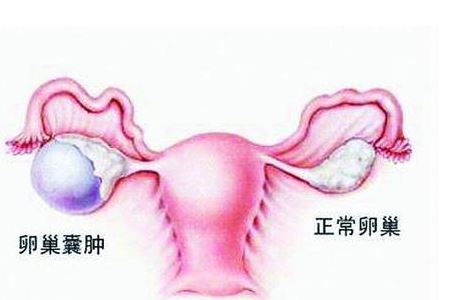 简单又好看的发型扎法轻松掌握流行造型技巧