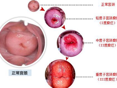 女士超短发型的文化与审美变迁研究