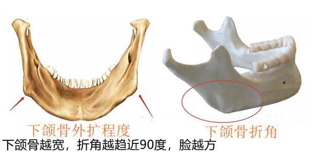 甩饼脸是形容哪个明星的脸型_方脸怎么改善脸型_矫正牙齿会改善脸型吗